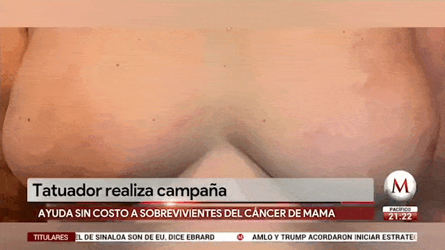 Sobrevivientes al cáncer de mamarecuperan su vida con un tatuaje(2019)